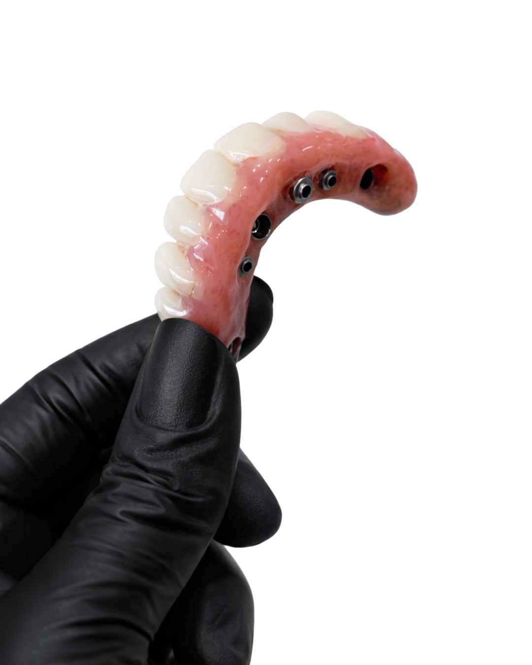 Full-Arch Implant  -  passive fit and design